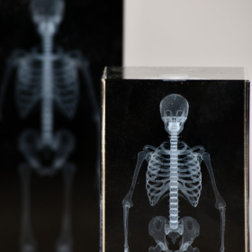 3D Human Skeleton Radiography