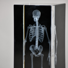 3D Human Skeleton Radiography